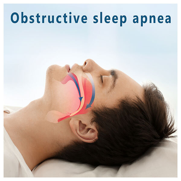 Apnea